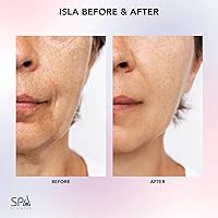 Spa Sciences ISLA Ice + Heat Contouring Roller with Rose Quartz Globes — image 3