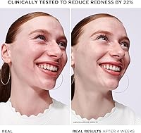 IT Cosmetics Bye Bye Redness Serum 1oz — image 3