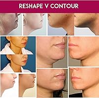 Anacis Advanced Neck Cream and Masks 12mL — image 9