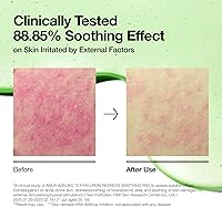 Anua Azelaic 10 Hyaluron Redness Soothing Pad (90 pads) — image 6