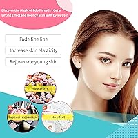 Elves PDO Threads Lift for Face and Body, 20pcs (26G60mm) — image 4