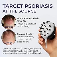 Pharmlitalia Flakes Shampoo 200mL — image 2