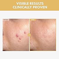 TOSOWOONG Black Snail Ginseng Serum 30ml — image 2