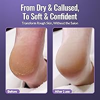 Footlogix Foot Care Callus Softener Combo — image 6