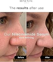 Rosental Organics Niacinamide Serum 5% Pore-Refining Treatment — image 5