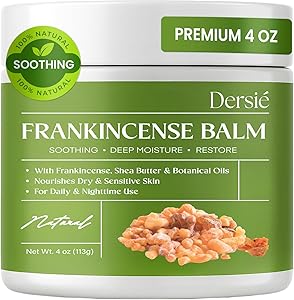 Dersie Frankincense Balm 4 oz Review