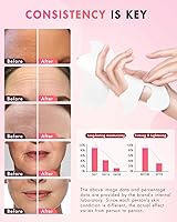 UKVOA Forehead Wrinkle & Smile Line Patches, 36pcs — image 6