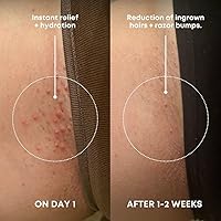 Bushbalm Ingrown Hair Exfoliating Scrub Sweet Escape 236mL — image 2