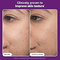 Paula’s Choice Pro Retinaldehyde Dual-Retinoid Advanced Treatment Serum 3.53oz — image 6