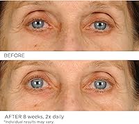 NASSIF MD Under Eye Smoother Firming Cream 0.5oz — image 8