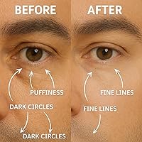 Disco Men's Eye Bag Treatment Roller Serum, 10mL — image 2