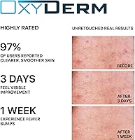 OxyDerm Butt & Thigh Acne Treatment Pads — image 4