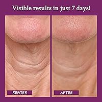 PRAI Neck Creme for Tightening & Firming, 4oz — image 3