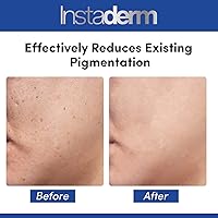 Instaderm Anti Aging Dark Spot Corrector Serum — image 5