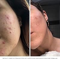 Bioelements Crucial Moisture 2.5 fl oz — image 5