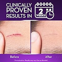 Cicatricure Advanced Scar Gel 2 oz — image 3
