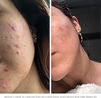 Bioelements Moisture Positive Cleanser 6 Fl Oz — image 5