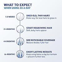 Rogaine Men's Extra Strength 5% Minoxidil Topical Solution, 2 fl. oz — image 7