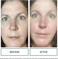 Replenix Age Restore Anti-Wrinkle Retinol Eye Repair 0.5oz — image 7