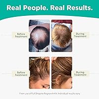 Shapiro MD Hair Growth Experts Shampoo and Leave-in Conditioner 8oz — image 5