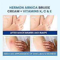Hermon Arnica Bruise Cream 4oz — image 9