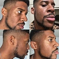 Stop Guessing The Fast Dark Spot Remover — image 4