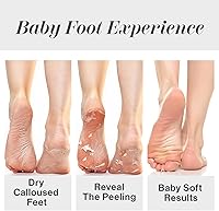 Baby Foot Original Exfoliation Foot Peel - Lavender Scented — image 4