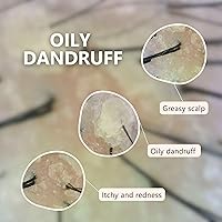 Aromase Dandruff Shampoo for Men 14oz — image 3