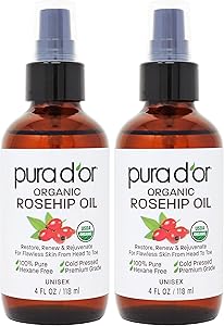 PURA D'OR Organic Rosehip Seed Oil 8oz Review