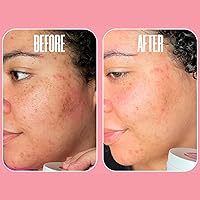 Divine Derriere Glycolic Acid Pads with Vitamin C - 50 Count — image 5