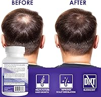 Propidren by HairGenics DHT Blocker & Hair Growth Capsules — image 7