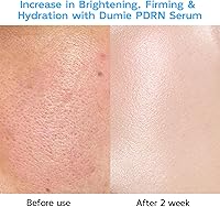 Dumie Salmon DNA PDRN Anti-Aging Serum 5000ppm — image 4