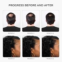 Rivermint Premium Hair Strengthening Shampoo 9.14oz — image 4