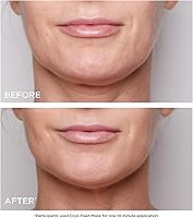 Clarins Cryo-Flash Face Mask — image 4