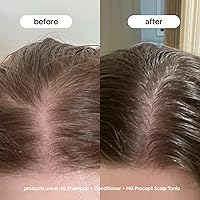 BONDIBOOST Procapil Scalp Treatment 4.23oz — image 3