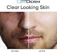 OxyDerm Sulfur Purifying Clay Mask — image 3