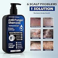 Oely Antifungal Shampoo for Seborrheic Dermatitis, Folliculitis & Scalp Psoriasis, 10.1 Fl Oz — image 2