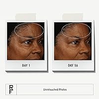 Rodan + Fields Redefine Regimen Skincare Kit — image 3