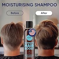 Moerie Ultimate Hair Growth Shampoo 8.45oz — image 4