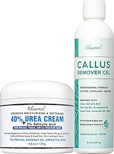 Ebanel Professional Callus Remover Set with Urea 40% Cream and Salicylic Acid Gel Review