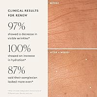 Naked & Thriving Wrinkle-Fighter Set (30mL each) — image 4