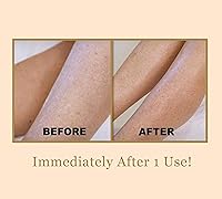 DIAMONDBUFF Microderm Exfoliation Tool — image 3