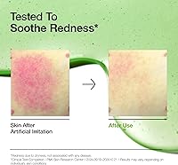 Anua Azelaic Acid 10% Hyaluron Redness Soothing Serum 30mL — image 3