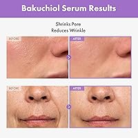Bakuchiol Serum 30ml — image 2