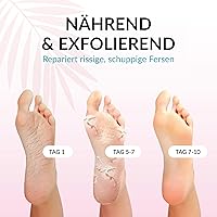 Summer Foot Premium Foot Mask for Men Double Pack — image 4