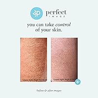 Perfect Image Gly + Sal Exfoliating Body Lotion 8% Glycolic Acid 2% Salicylic Acid 8oz — image 8