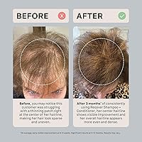 ACTIIV Recover Thickening Conditioner — image 6