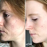 Three Ships Refresh Papaya + Salicylic Acid Cleanser 3.4oz — image 4