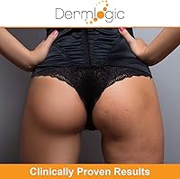 Dermlogic Anti-Acne Thigh & Buttocks Treatment 6.09oz — image 3