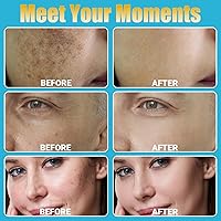 MONESAO Microneedling Skin Care Kit for Face, Hair & Beard — image 4